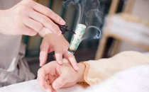 艾灸可以治失眠吗 失眠艾灸什么穴位