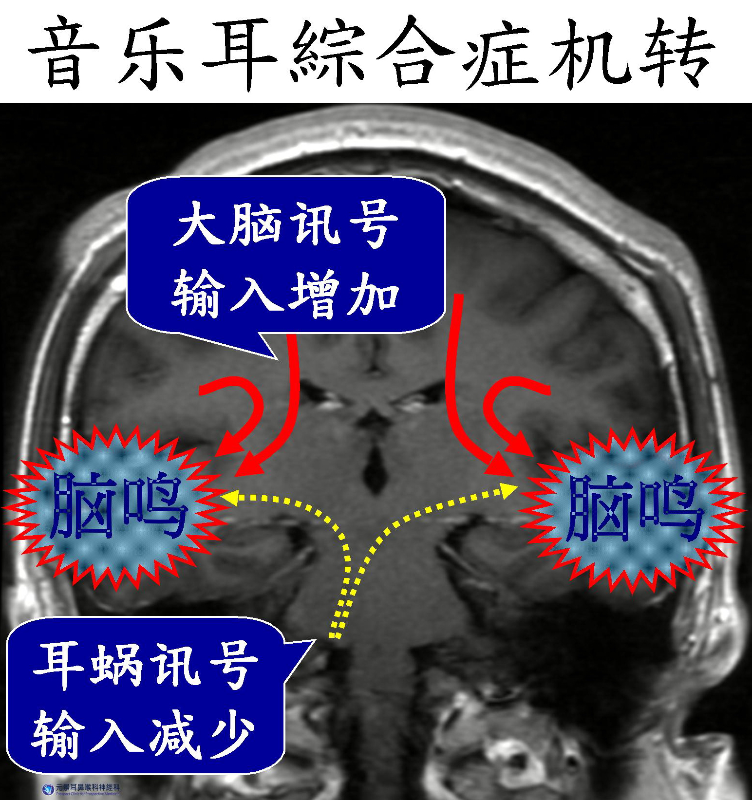  60岁主妇常听见