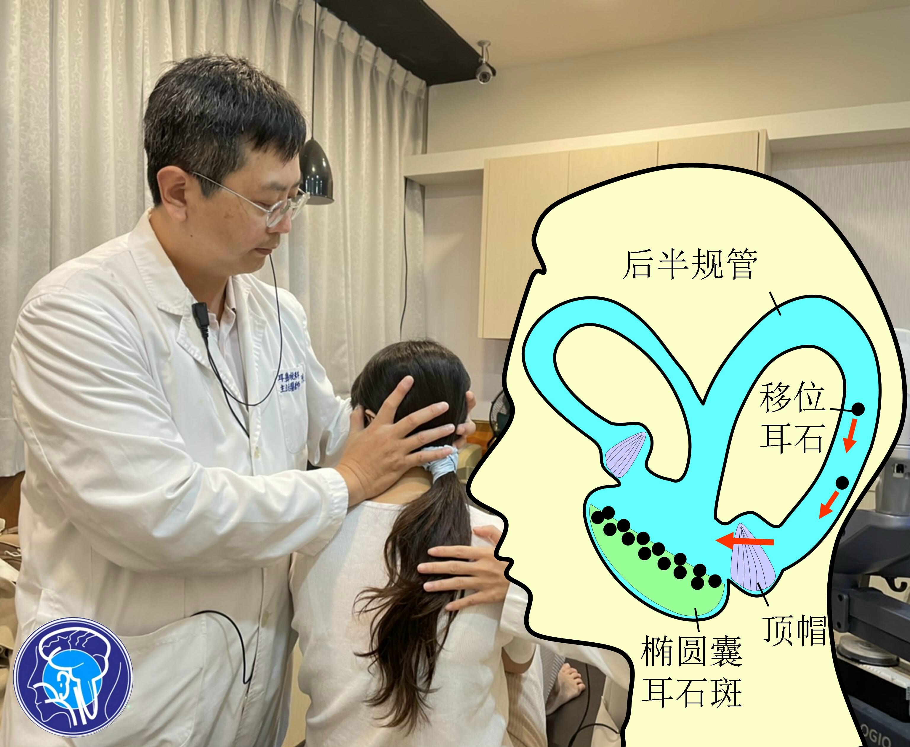40岁女子经常肩颈痠痛 睡觉时头晕 就医后发现是半规管内耳石沉积